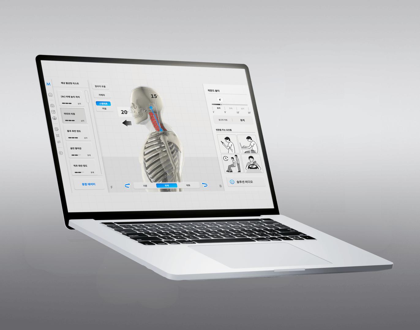 moti physio concordia